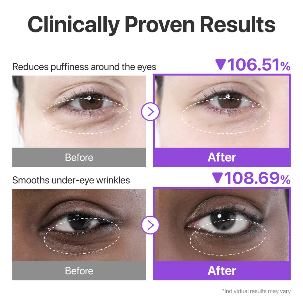 No.9 NAD Collagen Under Eye Patches-5 Pairs