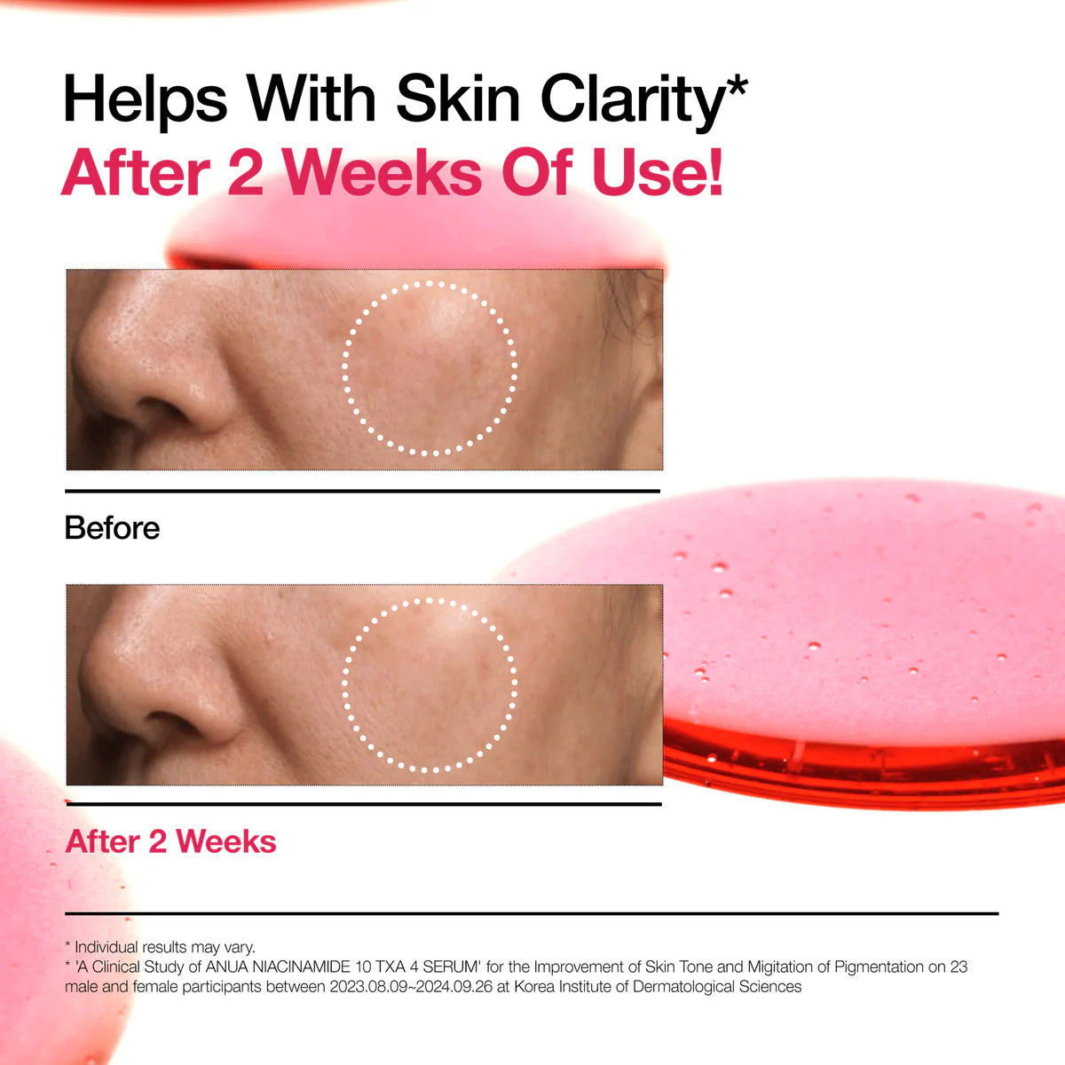 NIACINAMIDE 10% + TXA 4% SERUM 30ml