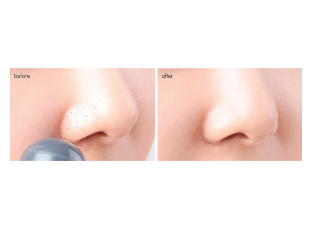 TAKOPORE BLACKHEAD SCRUB STICK