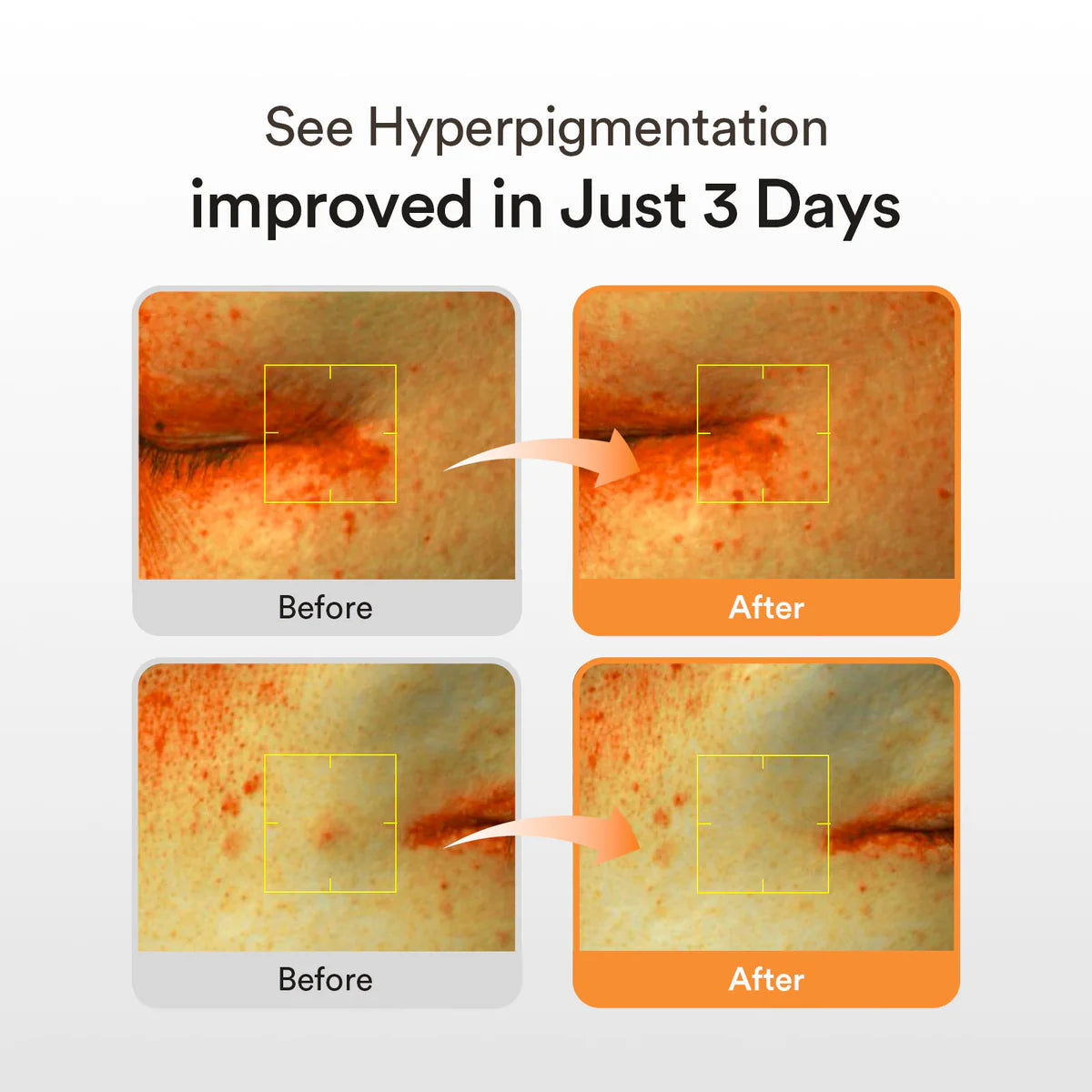 Abib Glutathiosome dark spot serum  Vita drop