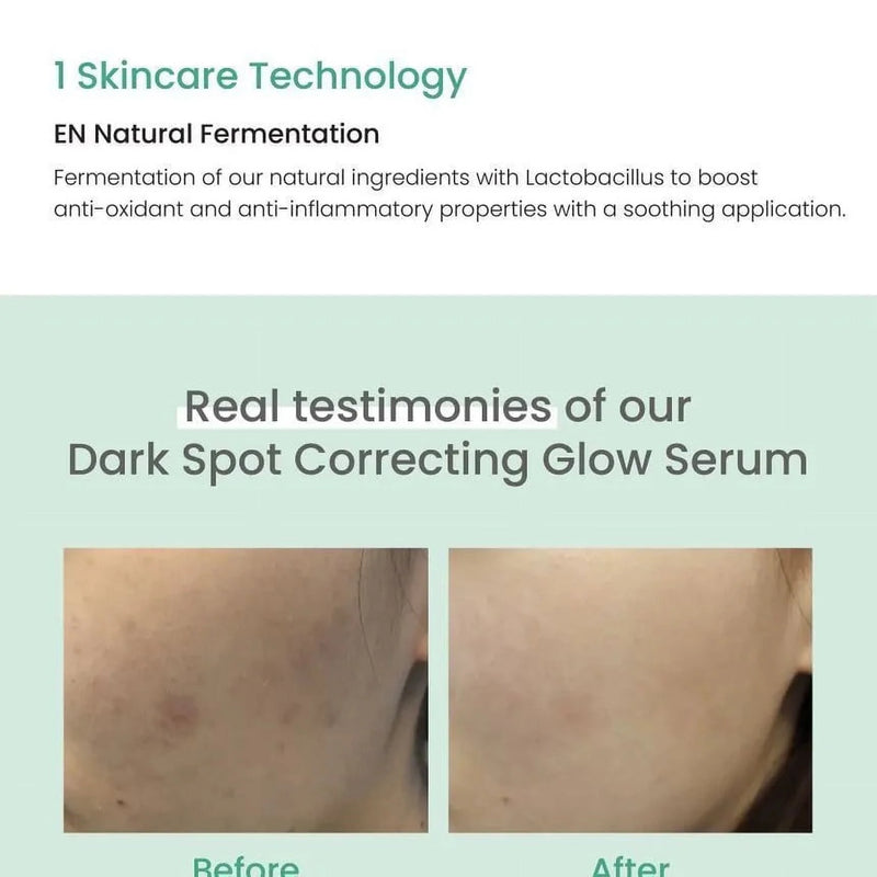 Dark Spot Correcting Glow Serum 50ml
