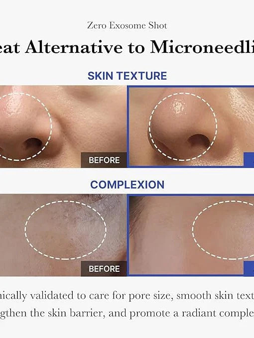 ONE DAY EXOSOME SHOT PORE AMPOULE 2000