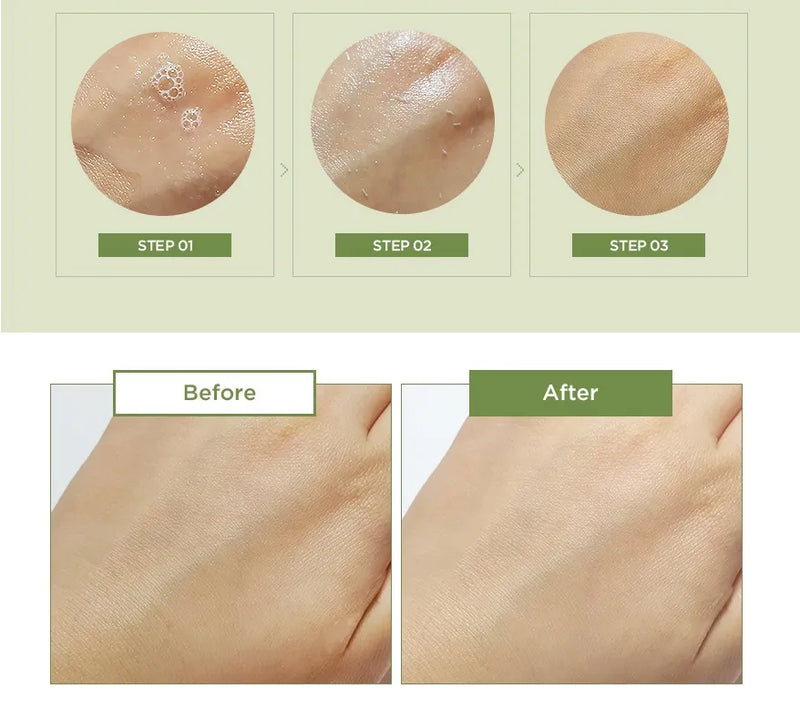 SMOOTH BODY PEEL