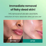 DR.G BRIGHTENING PEELING GEL 120G