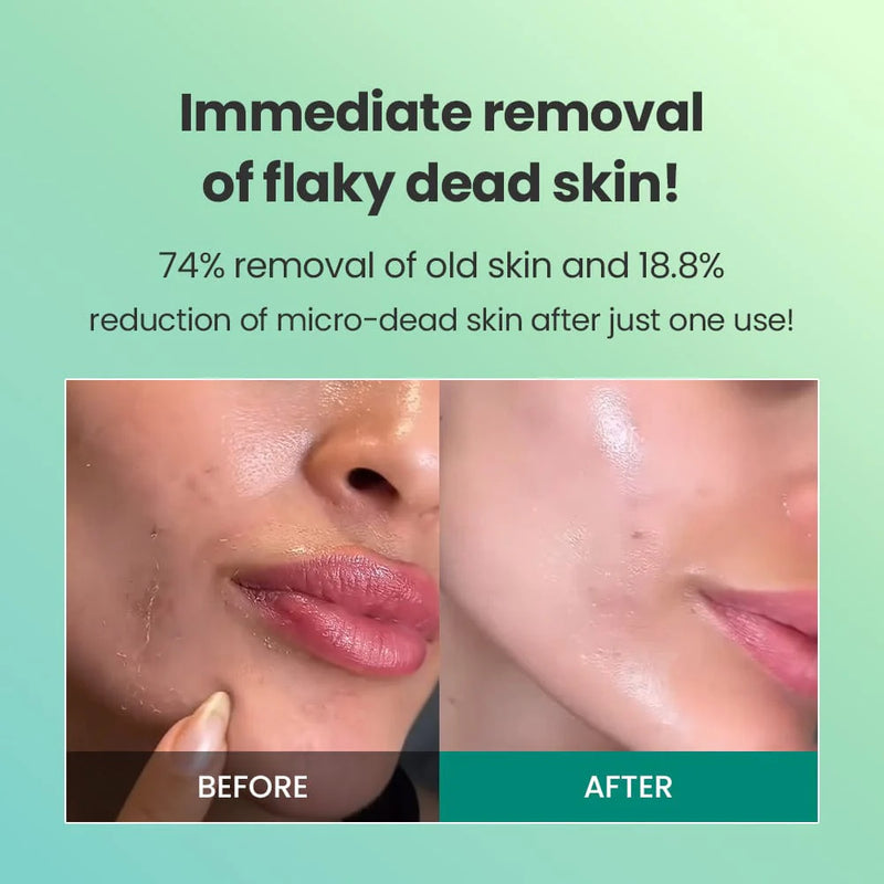 DR.G BRIGHTENING PEELING GEL 120G