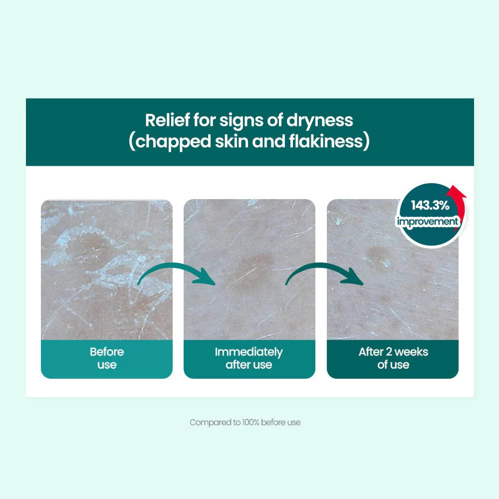 DR.G R.E.D BLEMISH CLEAR MOISTURE CREAM_70ML