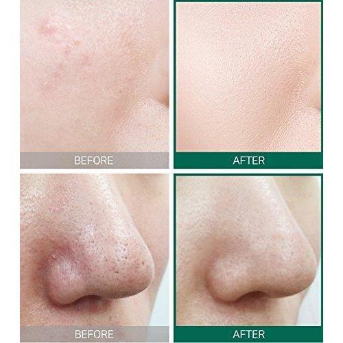 SOME BY MI AHA BHA PHA 31DAYS MIRACLE TONER-Kpop Beauty