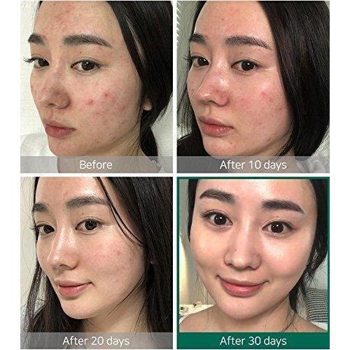 SOME BY MI AHA BHA PHA 31DAYS MIRACLE TONER-Kpop Beauty