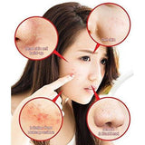 SOME BY MI AHA BHA PHA 31DAYS MIRACLE TONER-Kpop Beauty