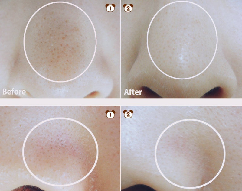 EGG PORE NOSE PACKAGE (7SHEETS)